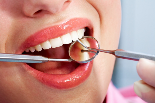 Limpieza dental